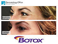 BOTOX® injections | Dermatologist Dr. Ellen Turner in the Dallas Area