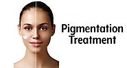 Skin pigmentation treatment coogee | Skin Care in Sydney, NSW