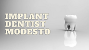 Dentist Modesto | Implant Dentist Modesto | ProSmile Family Dental