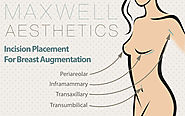 Website at https://www.maxwellaesthetics.com/breast-surgery-nashville/breast-augmentation/