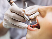 Trust only upon an Epping Dentist for following treatments