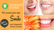 Teeth Color Enhancement Treatment – Ashwood Dental