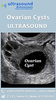 Ovarian cysts are small sacs, filled... - Ultrasound Dimensions | Facebook