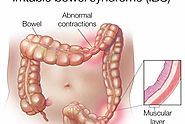 Ayurvedic Treatment for IBS