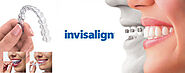 Why Invisalign Pennsylvania experts are becoming the best treatment or dental rectification?