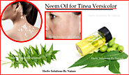 Neem Oil for Tinea Versicolor Natural Remedies and Natural Essential Oils