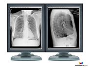 Pair (x2) Barco® Nio E-3620 MA 3MP Grayscale Medical Diagnostic Radiology Monitors (K9300248A)