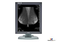 Barco® Nio MDNG-5121 5MP Grayscale Digital Mammography Monitor (K9601568)