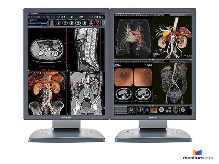 Barco® Nio® E3620 MA 3MP Grayscale Diagnostic Radiology Monitors A