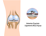 Website at https://regenusa.com/watch-out-for-these-7-common-knee-injuries-with-their-preventive-measures/