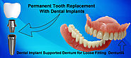 Show Your Dental Problem at best Dental implant in kolkata