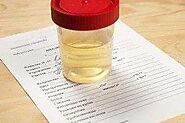 Urine Color Chart: How the Color of Your Urine Will Tell You What Could Be Going on in Your Body