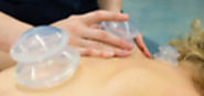 Qualified Cupping Therapy Specialist In Seattle, WA