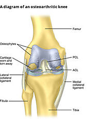 Dr. Sachin Chhabra | Knee Replacement in Indore