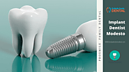 Dentist Modesto | Implant Dentist Modesto