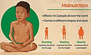 MALNUTRITION PROBLEM AND NEED FOR HOLISTIC SOLUTION