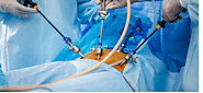 Laparoscopic Surgeory in Indore | Dr Sheela Chhabra