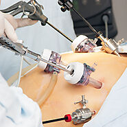 Laparoscopic Surgeon in Indore | Dr Sheela Chhabra