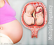 Window to the Womb Cardiff — An Overview On Twins Or Multiple Pregnancies