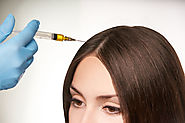 PRP Treatment for Hair Re-growth on Scalp