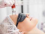 Laser Skin Resurfacing | Laser Skin resurfacing | Skin tags removal / Skin procedures