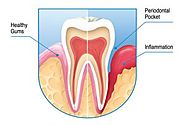 Dental Clinic | Dentist in South Delhi | SouthEx Dental