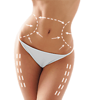 What are the Advantages of Liposuction?