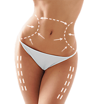 Liposuction Dallas | Liposuction Surgeon Dallas - CosmeticGyn Center