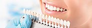Significant Overview Of Dental Veneers