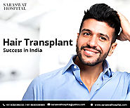 Is hair transplant successful in India?