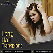 What are the Things you Need to Know About Long Hair Transplant?