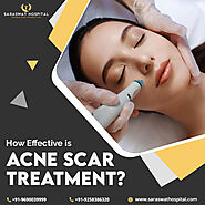 How Effective is Acne Scar Treatment?
