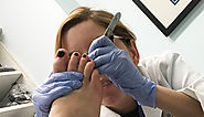 Foot Problems & Podiatrist - Bucks Foot Clinic