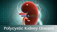 How To Improve Kidney Function | Natural Treatments to Reverse Kidney Disease Problems By Diet