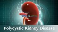 Reviews and Ratings on Polycystic Kidney Disease Treatment 2016