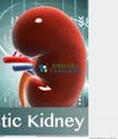 Best Polycystic Kidney Disease Treatment Reviews and Ratings 2014