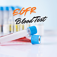 What is egfr blood test?