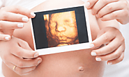 What Is A 4D Ultrasound Scan Used For? -