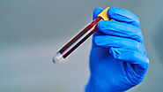 Things you must know before the blood test