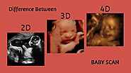 PPT - Difference Between 2D, 3D, And 4D Ultrasound Baby Scan PowerPoint Presentation - ID:8491961