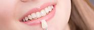 Get Your Crooked Teeth Repair in just ew days with Expert Porcelain Veneers Melbourne Treatment