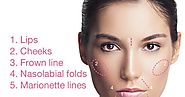 Avellina Aesthetics: Reverse The Signs Of Aging With Dermal Filler Injections