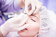 Why It Is Beneficial To Invest on Dermal Fillers?