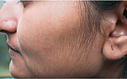 rmedspa - Laser Hair Removal Lees SummitLaser Hair Removal | Tattoo Removal - Rajeunir Medic...Rmedspa Offering advan...
