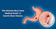 The Ultimate Must-Have Medical Guide To Gastric Ulcer Disease