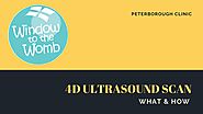 Know About 4D Ultrasound Scans