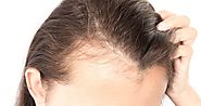 Are you completely aware of the Hair Replacement Systems in Pakistan? Do you know the Best Place to get them done? – ...