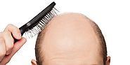 Hair Transplant in Karachi Prices very a lot, where to find the Best Prices with the Best Rates? – simply health zone