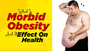 What Is Morbid Obesity And Its Effect On Health | Neuherbs Health University