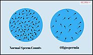 Oligospermia-Related Things To Keep In Mind